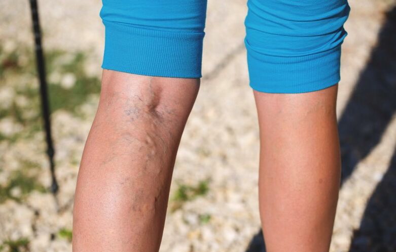 Poškození dolních končetin