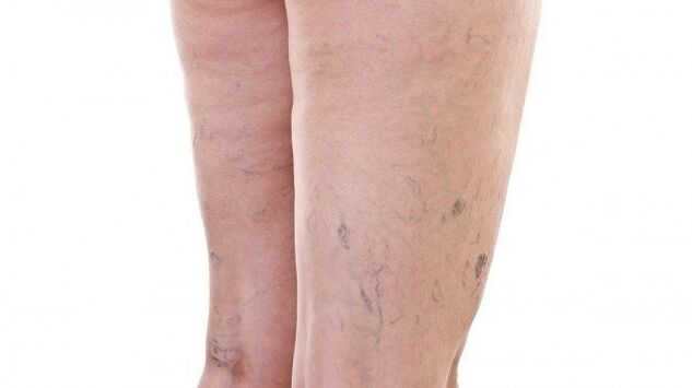 Příznaky krevních cév